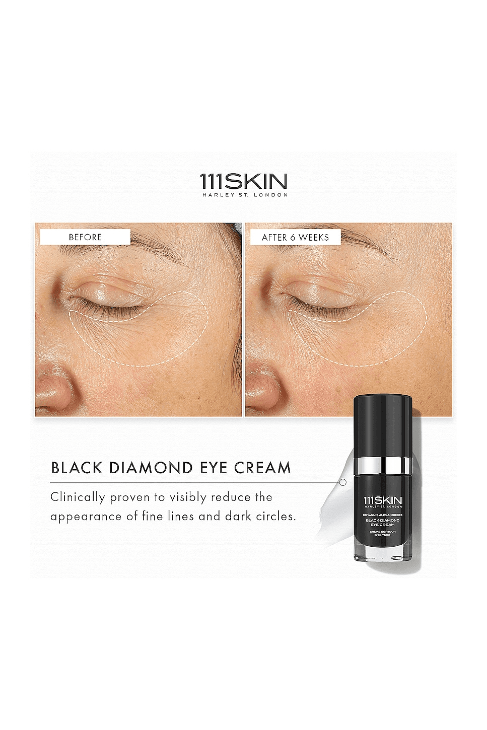 Black Diamond Eye Cream — Image 2